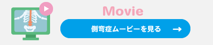 側弯症ムービーを見る